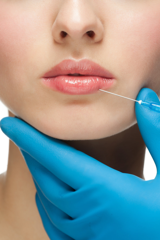 lip injections augmentation botox injection lips before know surgery fillers implants enhancement thin types everything need techniques face course dallas