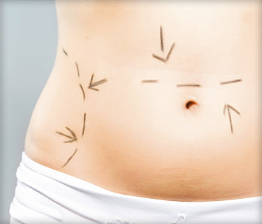 Dallas's Best Abdominal Liposuction Alternative: 5 Things To Know About  Abdominal AirSculpt®
